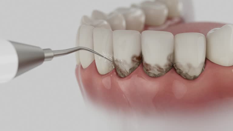 Trusted Tooth Extraction service in North Augusta, SC - Dentist Open Now